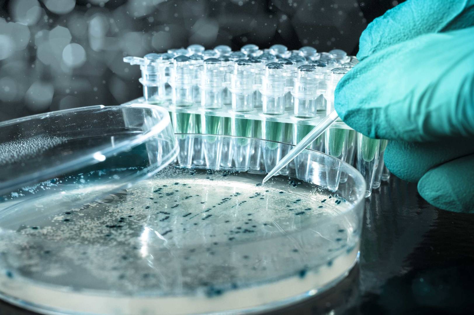 Plasmid DNA isolation